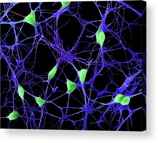 Central Nervous System Acrylic Print featuring the photograph Cortical Neurons by Dennis Kunkel Microscopy/science Photo Library