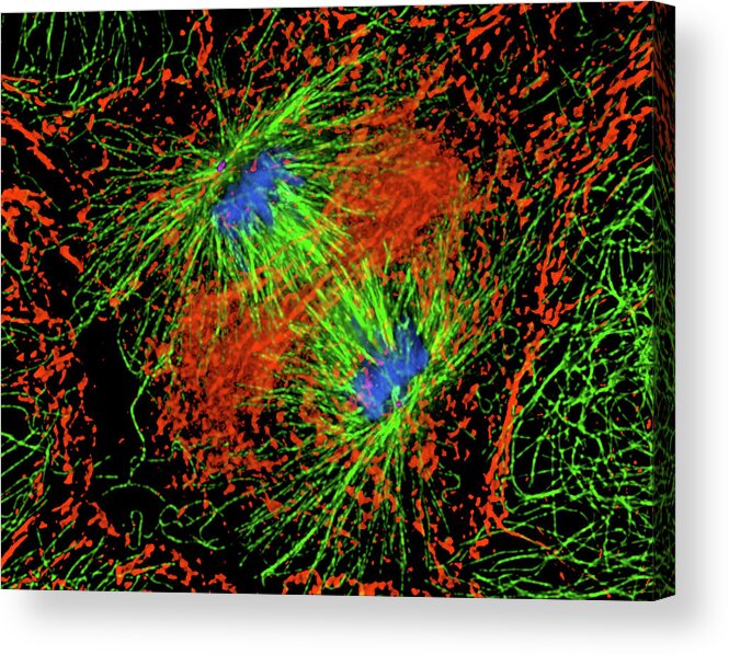 Magnified Image Acrylic Print featuring the photograph Mitosis Cell Division #7 by Dr Alexey Khodjakov/science Photo Library