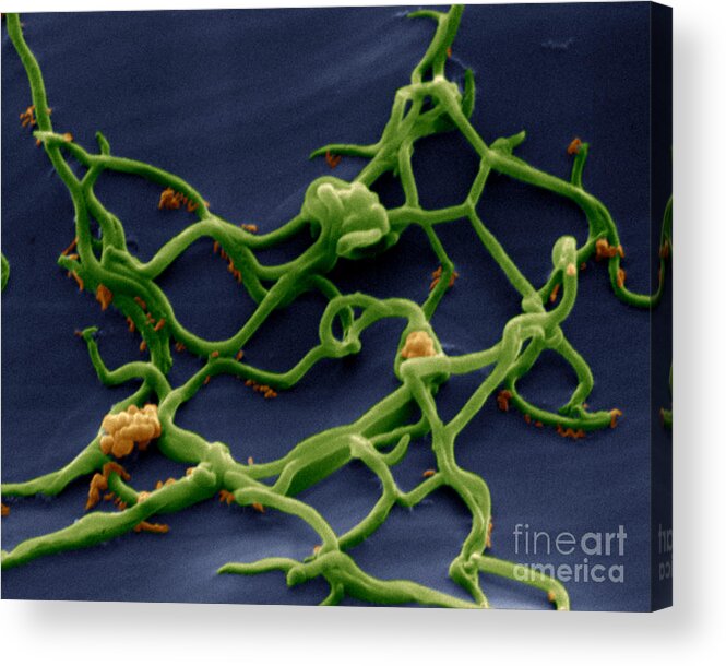 Micrograph Acrylic Print featuring the photograph Borrelia Burgdorferi by Eye of Science