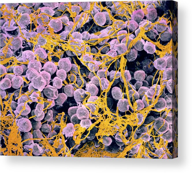Fat Cell Acrylic Print featuring the photograph Coloured Sem Of Adipose Tissue Showing Fat Cells by Prof. P. Motta/dept. Of Anatomy/university \la Sapienza\, Rome/science Photo Library
