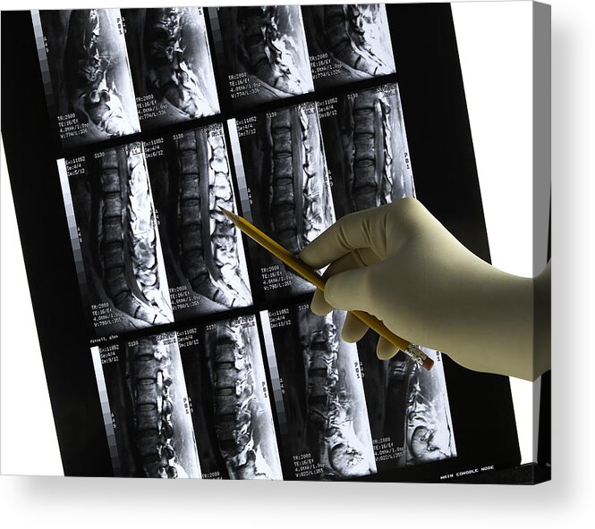 Expertise Acrylic Print featuring the photograph Lower back MRI scan with gloved physician's hand & pencil by FreezeFrameStudio