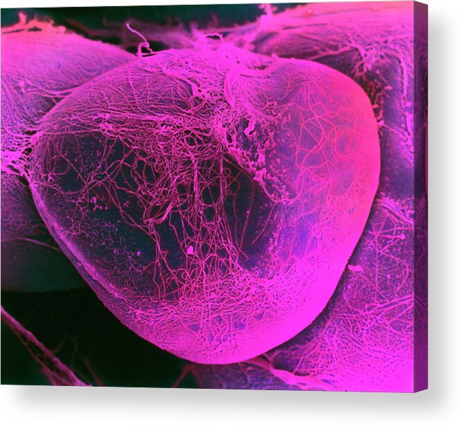 Adipocyte Acrylic Print featuring the photograph Sem Of An Adipocyte Fat Cell by Steve Gschmeissner/science Photo Library