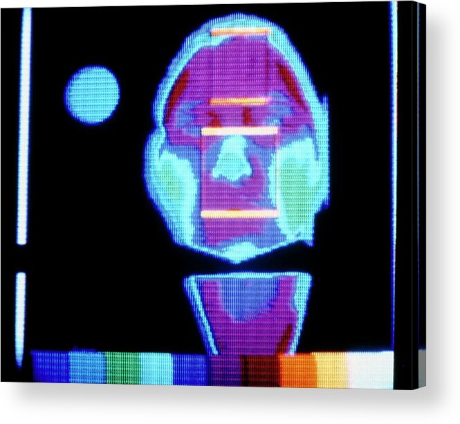 Thermography Acrylic Print featuring the photograph Thermogram Of Face Prior To Taking Alcoholic Drink by Science Photo Library