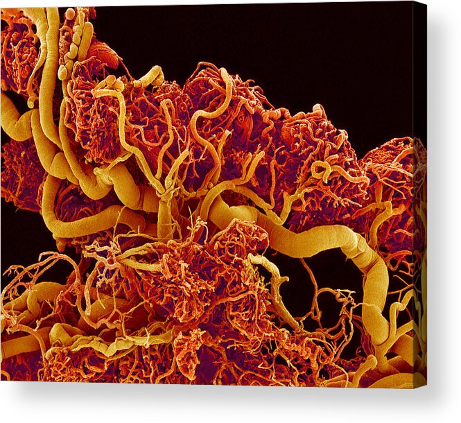 Ovary Acrylic Print featuring the photograph Blood Vessels In A Frog Ovary, Sem #1 by Susumu Nishinaga