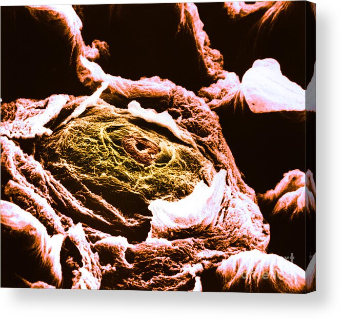 Tongue Acrylic Print featuring the photograph Human Tongue Papilla, Sem #2 by Omikron