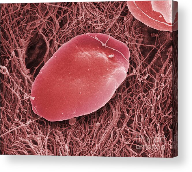 Science Acrylic Print featuring the photograph Blood Platelets, Sem #1 by Ted Kinsman