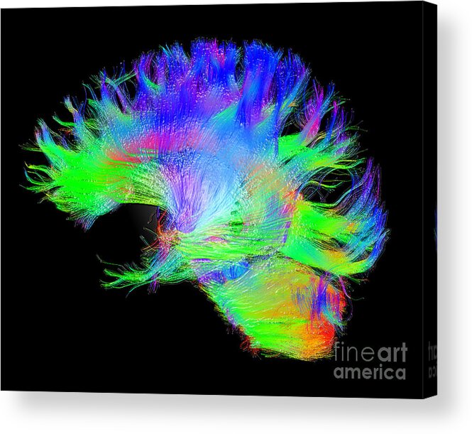 Brain Mri Acrylic Print featuring the photograph Fiber Tracts Of The Brain, Dti #1 by Living Art Enterprises