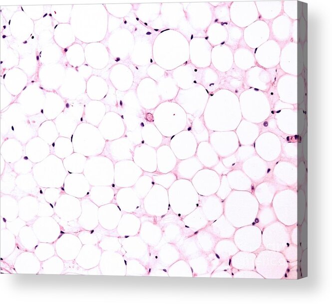 Biology Acrylic Print featuring the photograph Adipocytes #1 by Jose Calvo / Science Photo Library