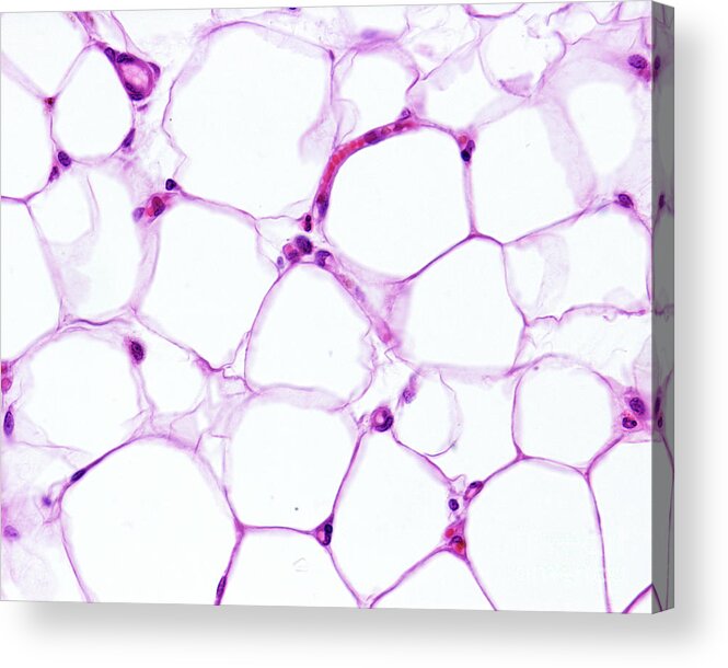 Adipocytes Acrylic Print featuring the photograph Adipocytes #1 by Jose Calvo / Science Photo Library