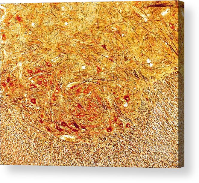 Cajal Acrylic Print featuring the photograph Motor Neurons In Spinal Cord #1 by Jose Calvo / Science Photo Library