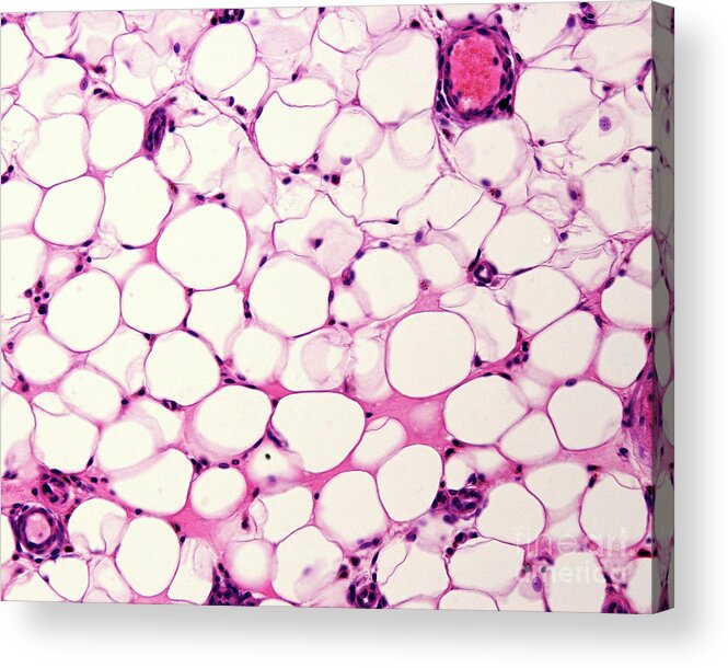 Adipocytes Acrylic Print featuring the photograph Adipose Tissue #2 by Jose Calvo / Science Photo Library