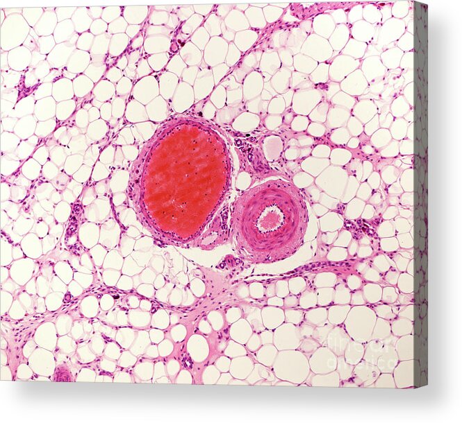Adipocytes Acrylic Print featuring the photograph White Adipose Tissue #2 by Jose Calvo / Science Photo Library