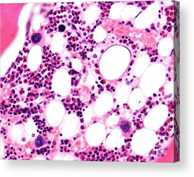 Connective Tissue Acrylic Print featuring the photograph Yellow Bone Marrow by Jose Calvo / Science Photo Library