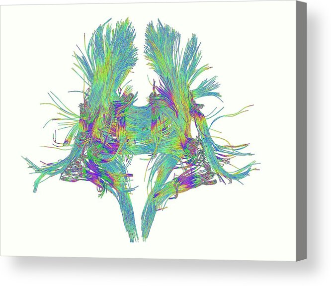 Brain Scan Acrylic Print featuring the photograph White Matter Fibres Of The Human Brain by Alfred Pasieka
