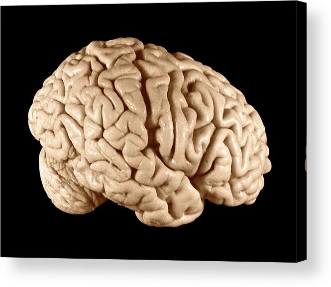 Brain Acrylic Print featuring the photograph Einstein's Brain #3 by Otis Historical Archives, National Museum Of Health And Medicine