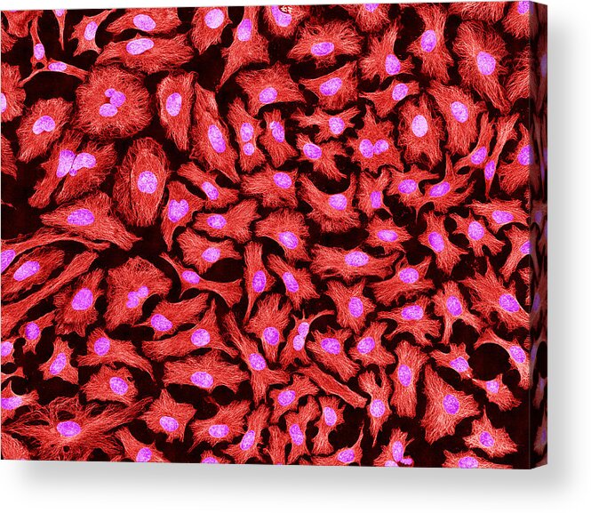 Science Acrylic Print featuring the photograph Hela Cells, Mfm #4 by Science Source