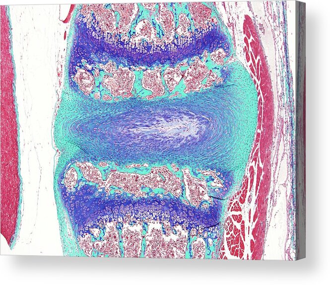 Tissue Acrylic Print featuring the photograph Intervertebral Disc #4 by Microscape