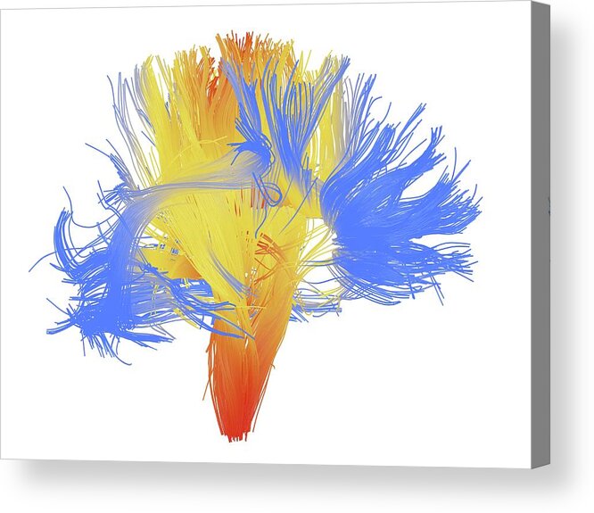 Brain Scan Acrylic Print featuring the photograph White Matter Fibres Of The Human Brain #8 by Alfred Pasieka