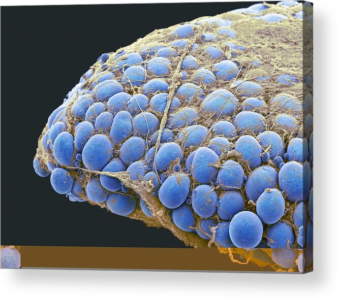 Adipocyte Acrylic Print featuring the photograph Fat tissue, SEM by Science Photo Library