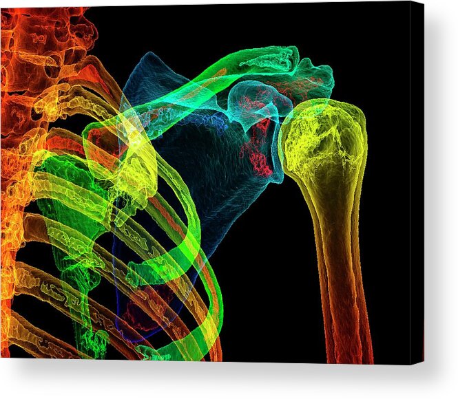 3-dimensional Acrylic Print featuring the photograph Normal Shoulder by K H Fung/science Photo Library