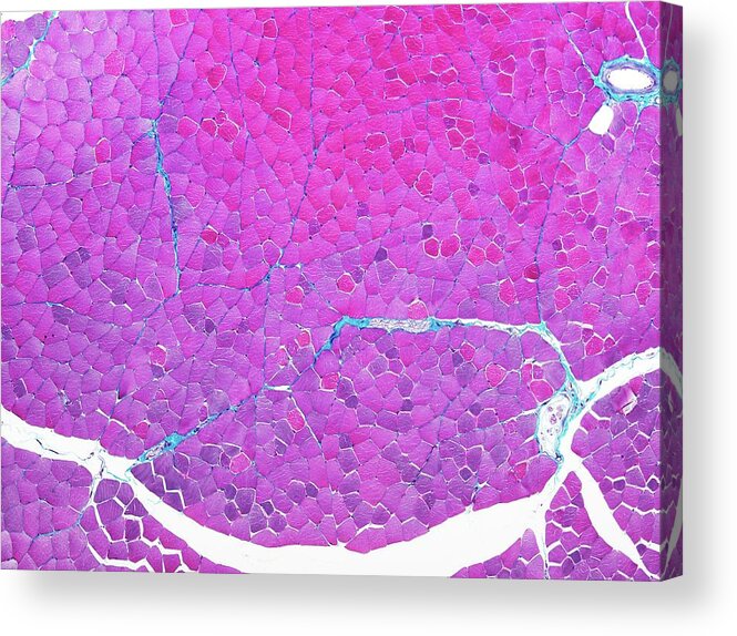 Tissue Acrylic Print featuring the photograph Skeletal Muscle Tissue by Microscape