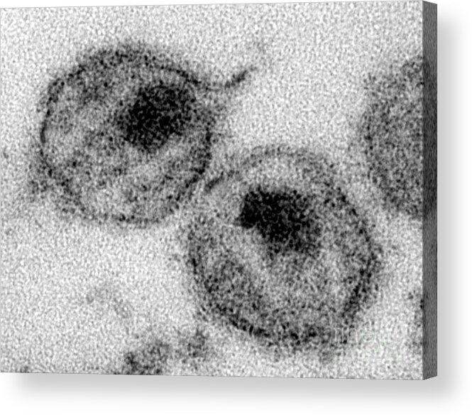 Transmission Electron Micrograph Acrylic Print featuring the photograph Hiv #5 by Science Source