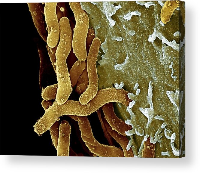 Helicobacter Pylori Acrylic Print featuring the photograph Helicobacter Pylori Bacteria, Sem #9 by 