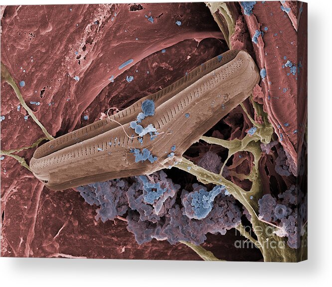 Bacteria Acrylic Print featuring the photograph Diatom With Thermophilic Bacteria by Ted Kinsman