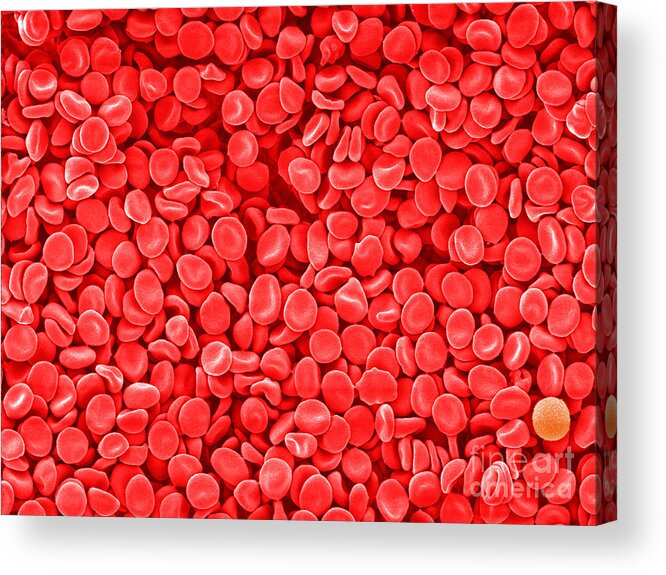 Red Blood Cells Acrylic Print featuring the photograph Red Blood Cells, Sem #2 by Scimat