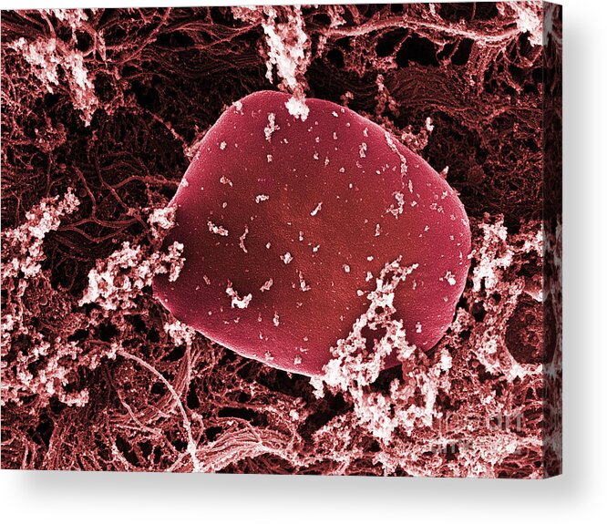 Science Acrylic Print featuring the photograph Blood Platelets, Sem #4 by Ted Kinsman
