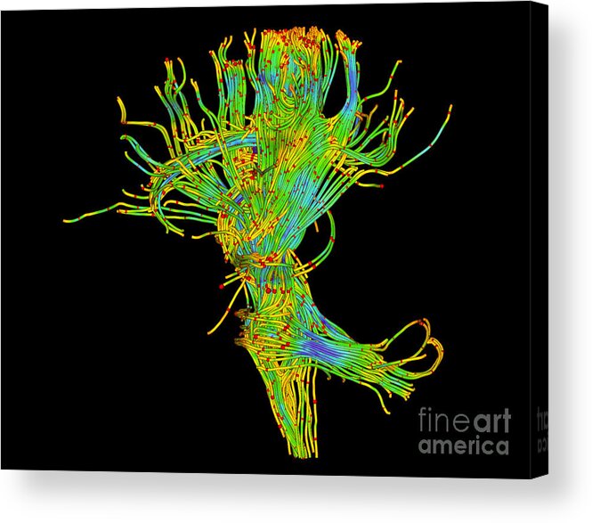 Mri Acrylic Print featuring the photograph Brain, Fiber Tractography Image by Scott Camazine
