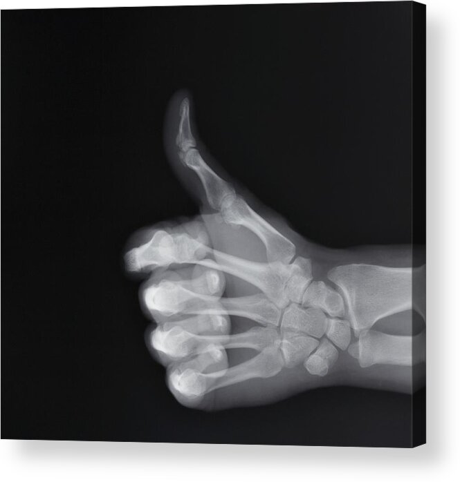 People Acrylic Print featuring the photograph X-ray of hand making thumbs up gesture by ER Productions Limited