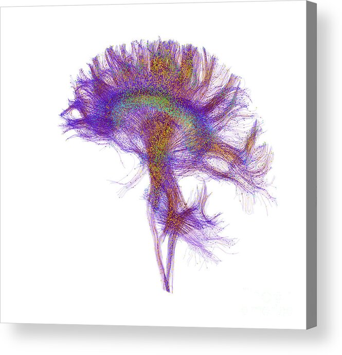 Mri Acrylic Print featuring the photograph Brain, Fiber Tractography Image #2 by Scott Camazine