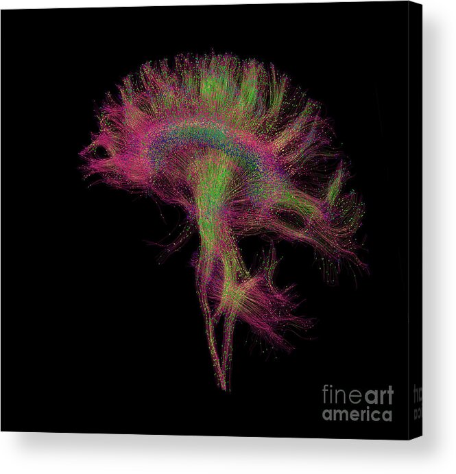 Mri Acrylic Print featuring the photograph Brain, Fiber Tractography Image #5 by Scott Camazine