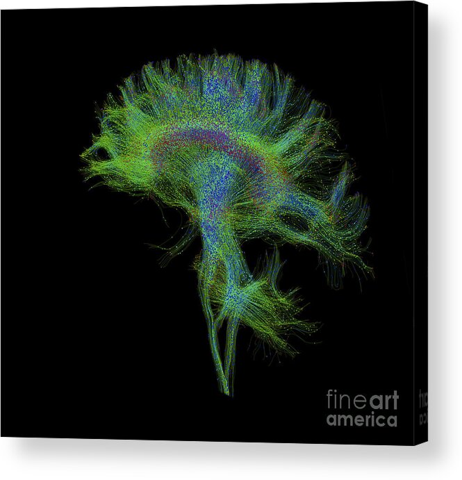 Mri Acrylic Print featuring the photograph Brain, Fiber Tractography Image #6 by Scott Camazine