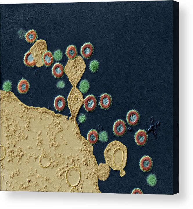 Acquired Immune Deficiency Acrylic Print featuring the photograph Effect Of Protease Inhibitors On Hiv Tem by Meckes/ottawa