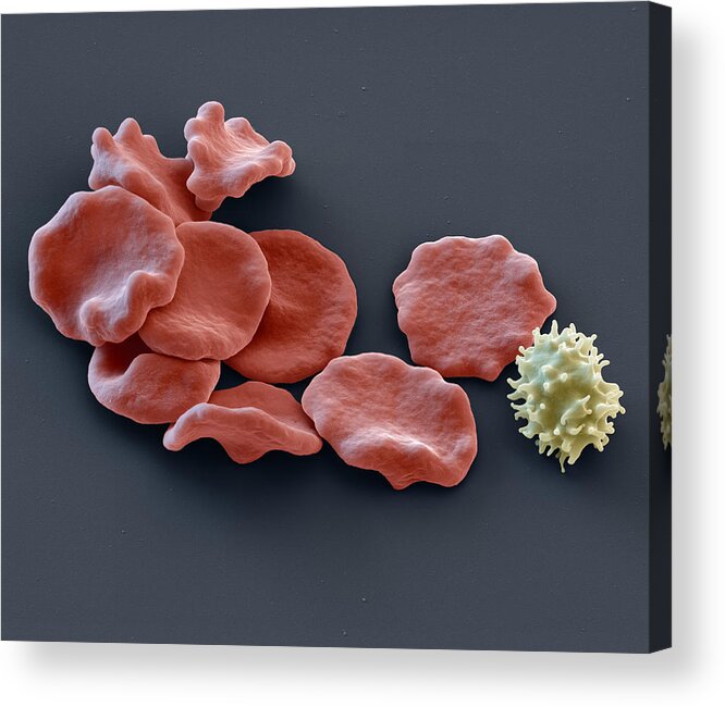 Blood Acrylic Print featuring the photograph Red Blood Cells And Lymphocyte, Sem #1 by Eye of Science