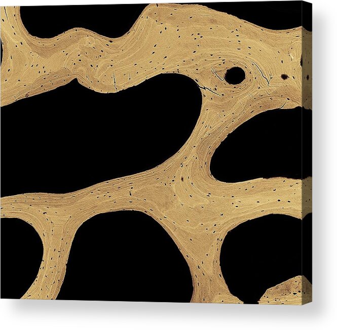 Backscattered Electrons Acrylic Print featuring the photograph Bone Cross-section #4 by Science Photo Library