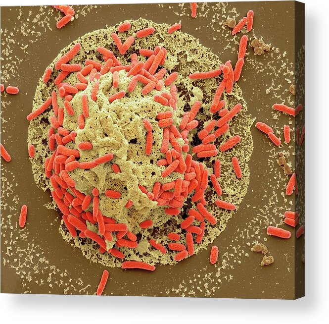 Bacteria Acrylic Print featuring the photograph E. Coli Induced Cell Death by Steve Gschmeissner