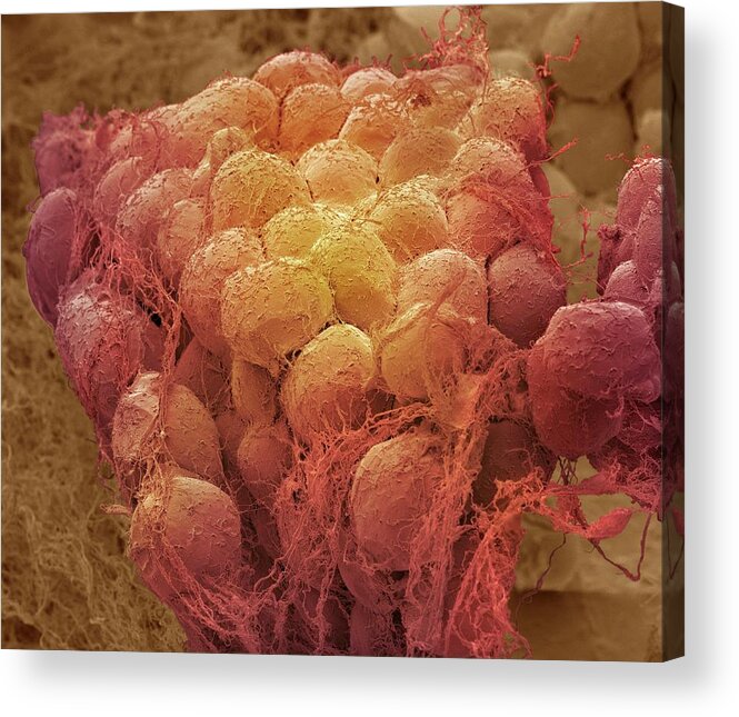 Adipocyte Acrylic Print featuring the photograph Fat Tissue by Steve Gschmeissner