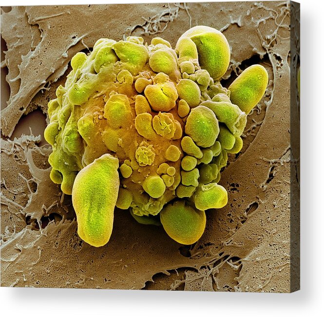 Anatomical Acrylic Print featuring the photograph Stem cell dying, SEM by Science Photo Library