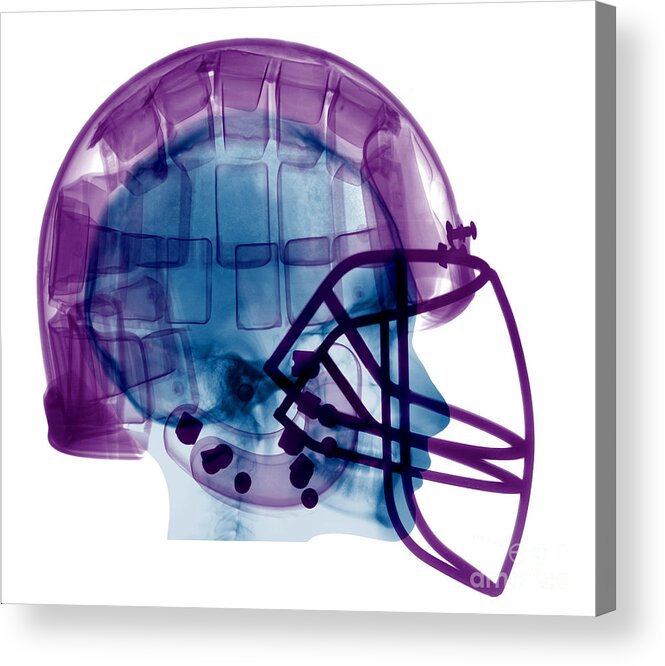 Football Helmet Acrylic Print featuring the photograph Football Helmet X-ray by Ted Kinsman