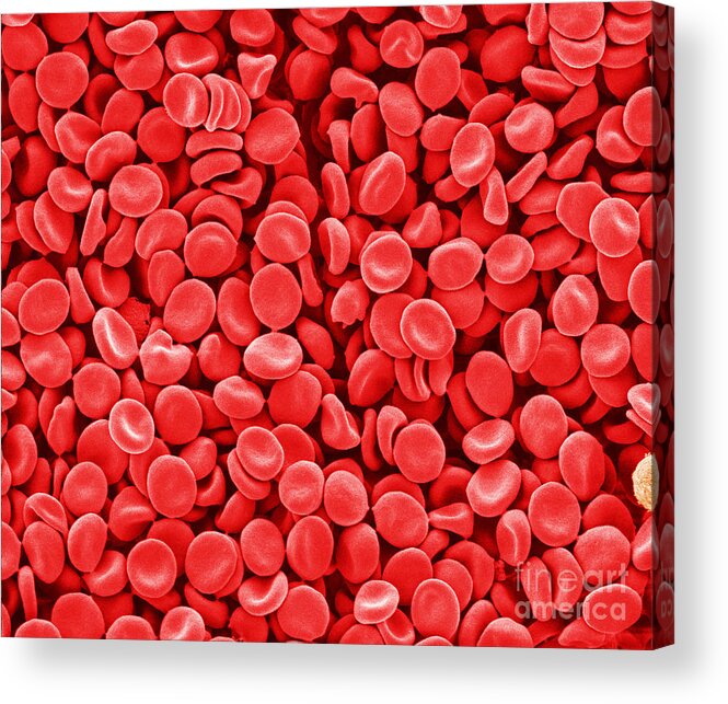 Red Blood Cells Acrylic Print featuring the photograph Red Blood Cells, Sem by Scimat