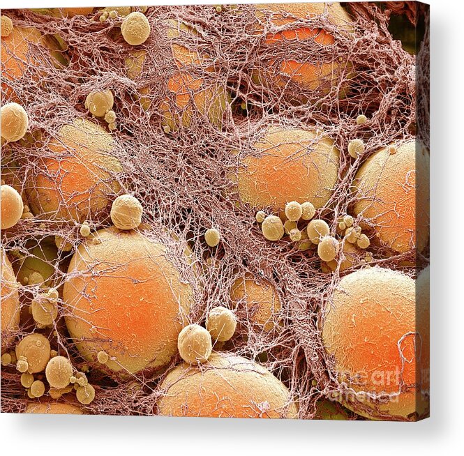 Adipocyte Acrylic Print featuring the photograph Fat Cells #13 by Steve Gschmeissner/science Photo Library