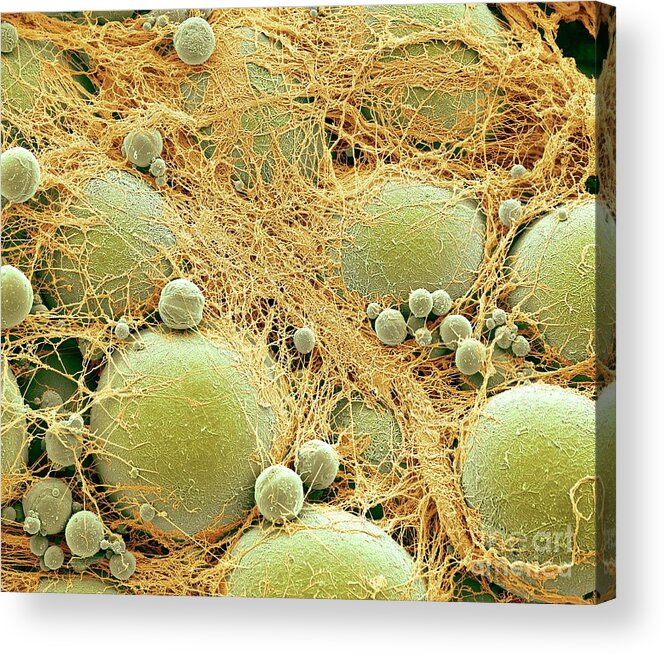 Adipocyte Acrylic Print featuring the photograph Fat Cells #15 by Steve Gschmeissner/science Photo Library