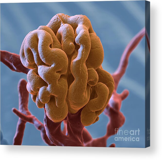 Capillary Acrylic Print featuring the photograph Glomerulus SEM by Eye of Science