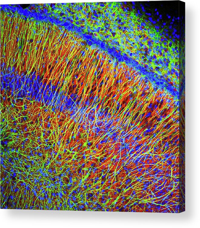 Anatomical Acrylic Print featuring the photograph Brain Cells #2 by Dr. Chris Henstridge