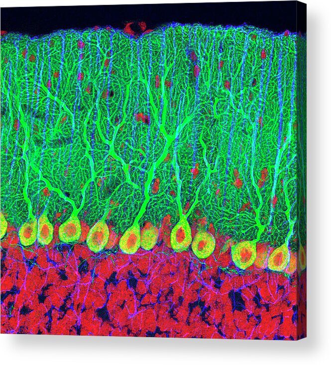 Purkinje Cell Acrylic Print featuring the photograph Purkinje Nerve Cells In The Cerebellum by Thomas Deerinck, Ncmir