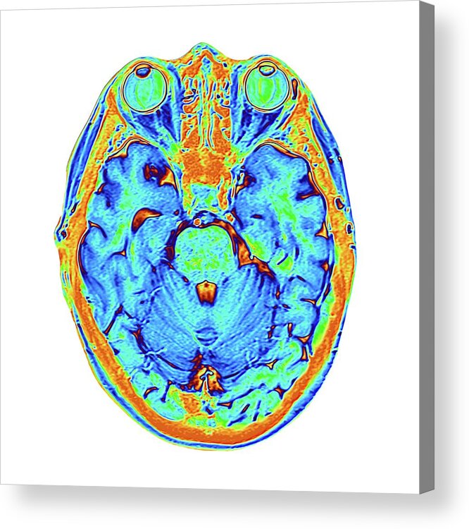 Scientific Imaging Acrylic Print featuring the photograph Coloured Mri Scan Of The Human Head #8 by Alfred Pasieka/science Photo Library