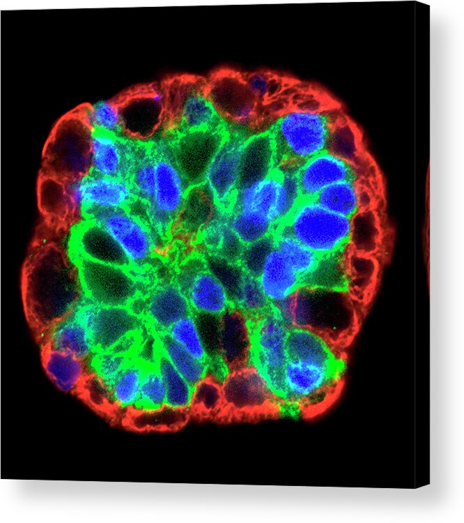 Cell Acrylic Print featuring the photograph Breast Cancer Stem Cell Culture by Salk Institute/national Cancer Institute/science Photo Library